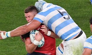 Rugby head injury — concussion assessment