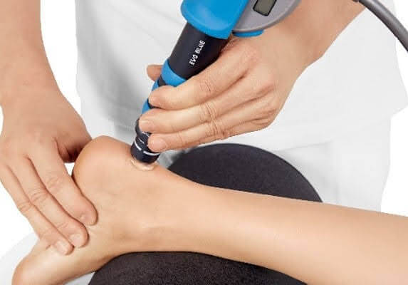 Shockwave therapy treatment for Achilles tendinopathy at Offaly Physio & Performance Lab