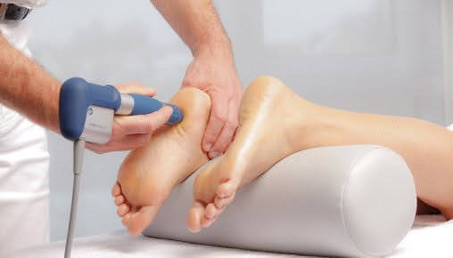 Shockwave therapy for plantar heel pain at Offaly Physio & Performance Lab