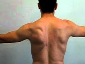 Scapular dyskinesis rehabilitation
