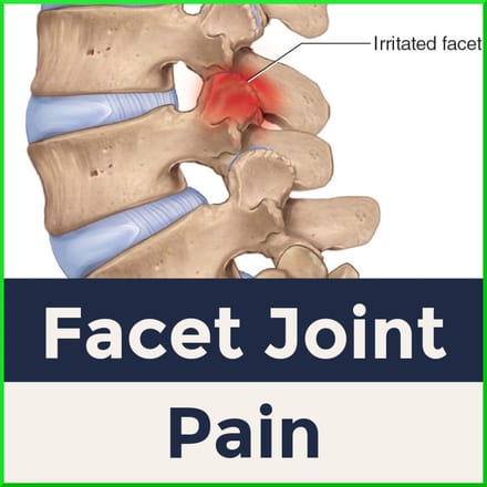 Facet joint pain treatment