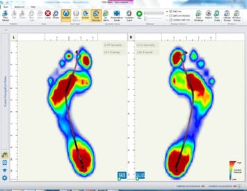 Gaitscan analysis