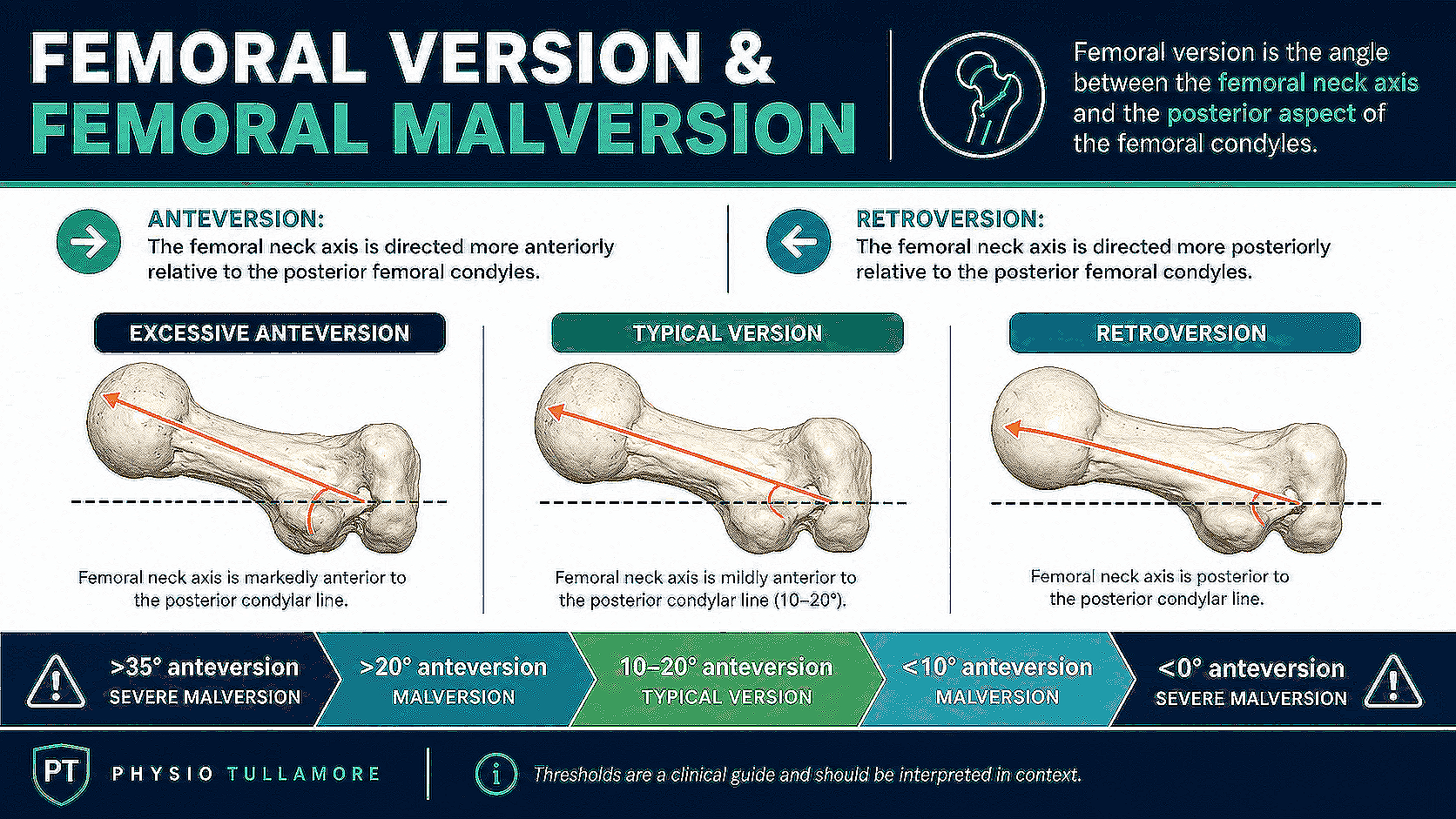 Femoral anteversion and retroversion