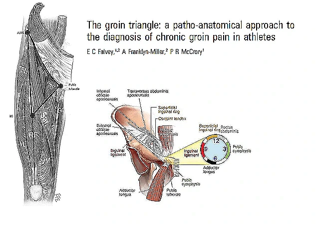 Groin and hip assessment